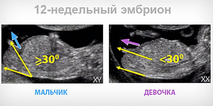 12-недельный эмбрион