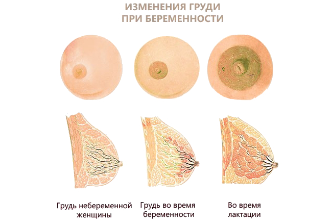Изменения груди у беременных