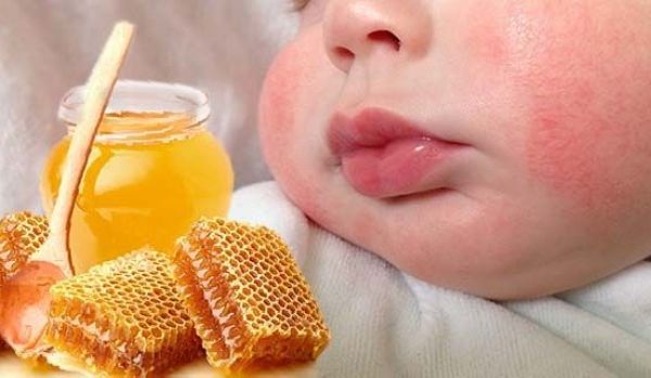 Можно ли есть мед во время кормления грудью