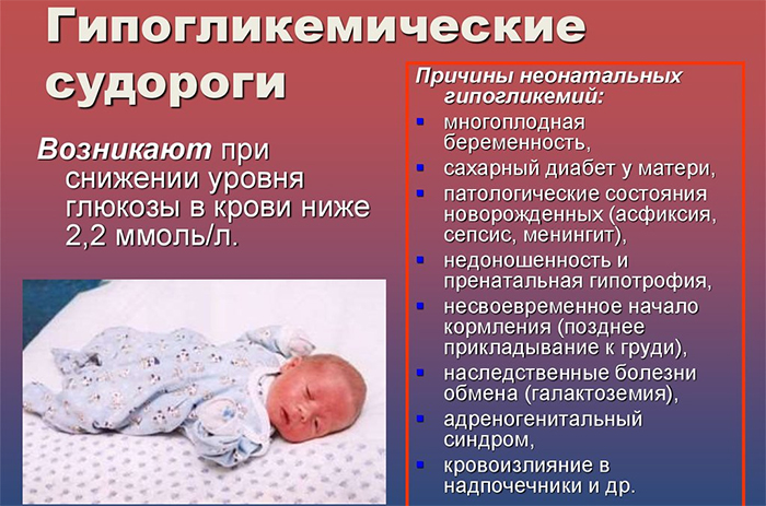 Гипогликемические судороги у новорожденных