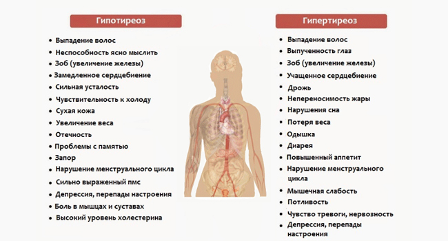 Симптомы гипотериоза и гипертиреоза