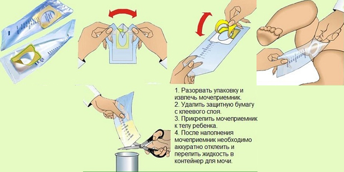Инструкция по применению мочеприемника
