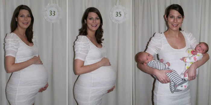 Женщина беременная и родившая двойню