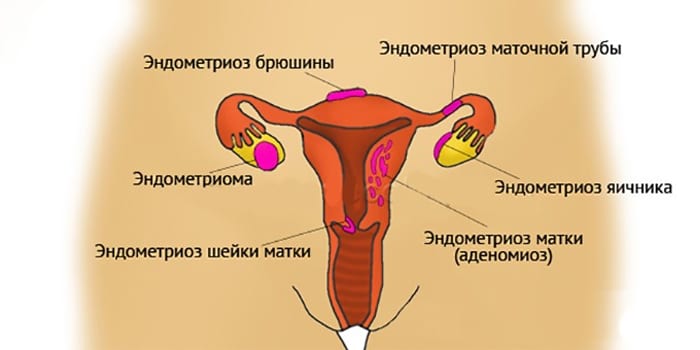 Локализация в органах репродуктивной системы
