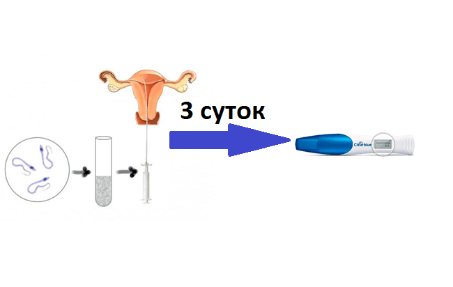 Оптимальный день подсадки эмбрионов