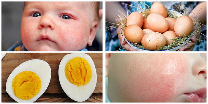 Проявление аллергии на яйца