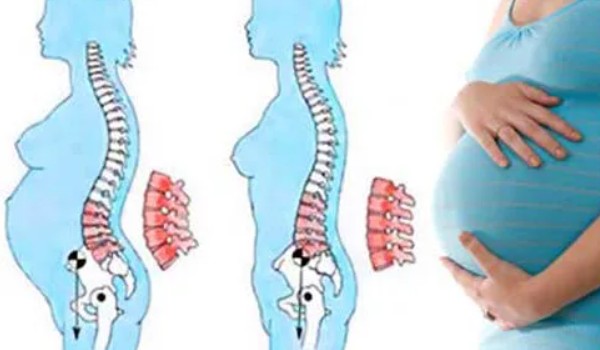 Профилактика проблем со спиной при беременности и после родов