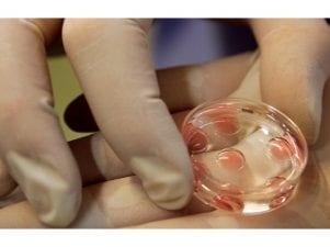 Перенос эмбрионов при ЭКО: как происходит имплантация