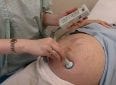 Доплер УЗИ при беременности