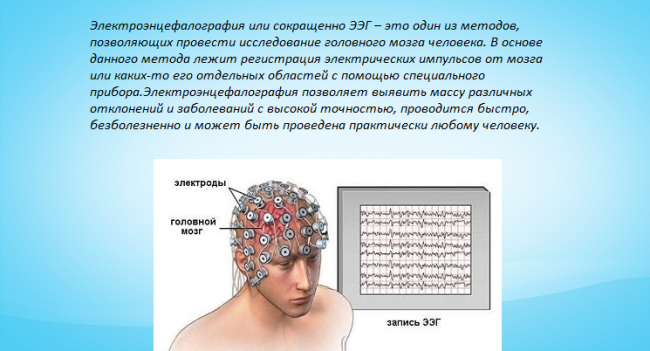 Ээг головы ребенку. ЭЭГ. ЭЭГ головного мозга. ЭЭГ головного мозга ребенку. Электроэнцефалография у детей.