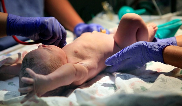 Травмы, которые могут возникнуть у младенцев во время родов