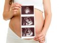 5 мифов про УЗИ во время беременности
