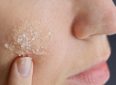 Как предотвратить шелушение кожи на лице