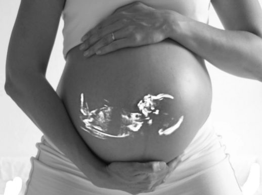 Как предотвратить преэклампсию при беременности