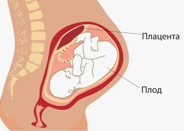 Что такое прирастание плаценты