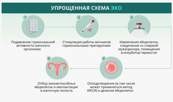 Что такое ЭКО