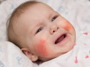 Что нужно знать о пищевой аллергии у новорожденных