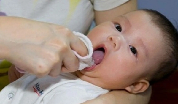 Что такое молочница у детей