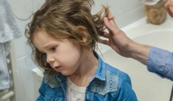 Причины выпадения волос у малышей