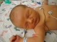 Что нужно знать родителям о желтухе новорожденных