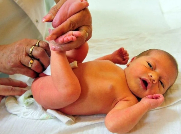 Что нужно знать родителям о желтухе новорожденных