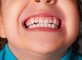 5 продуктов, полезных для детских зубов