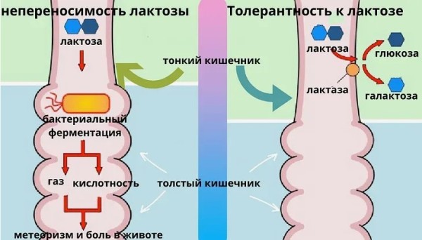 Признаки непереносимости лактозы у ребенка