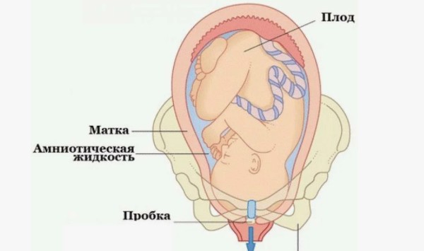 Что такое утечка околоплодных вод