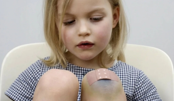 Как лечить у ребенка порезы и синяки