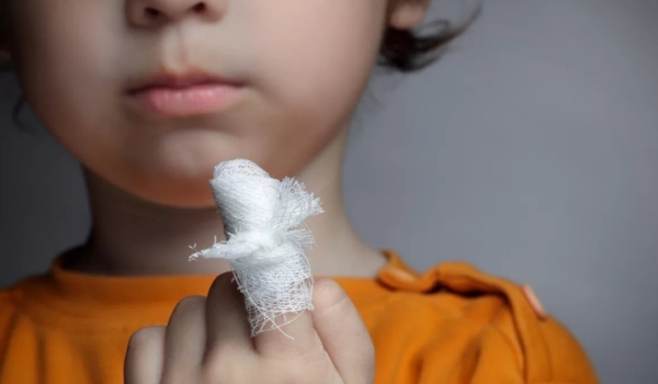 Как лечить у ребенка порезы и синяки